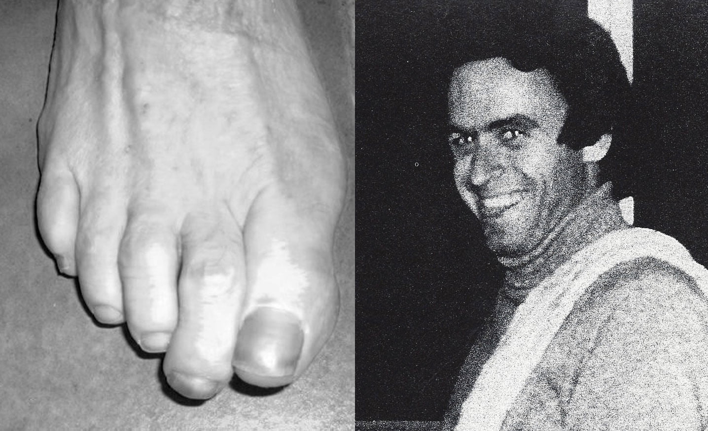 Ted Bundy's Feet